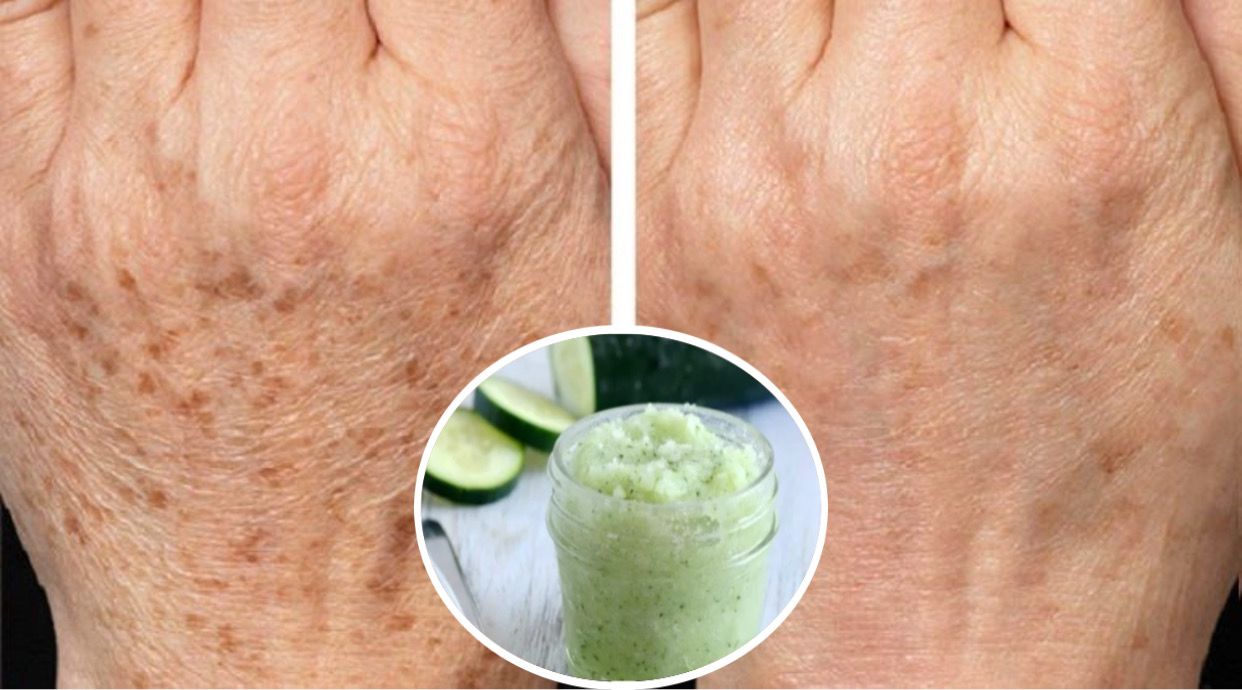 Mascarillas para Aclarar las Manchas en las Manos: Consejos y Remedios Naturales