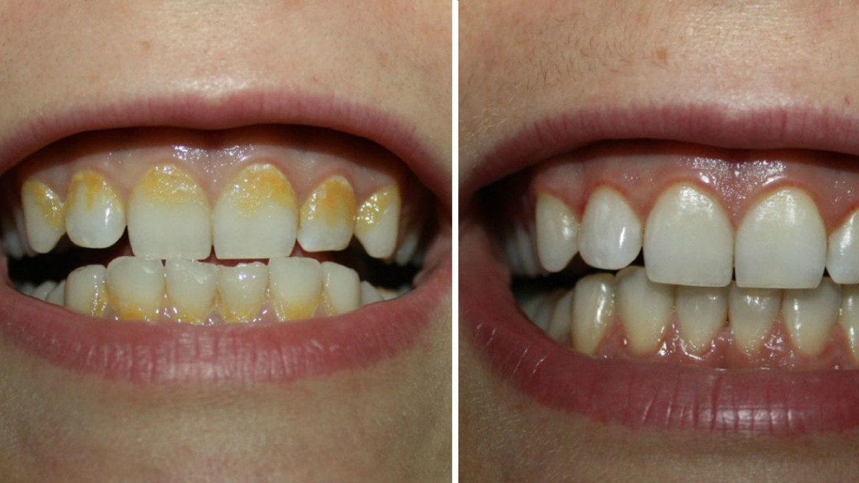 dental