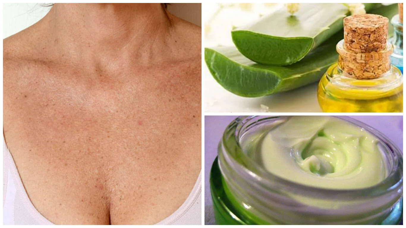 Cremas Naturales para Eliminar Arrugas en el Pecho