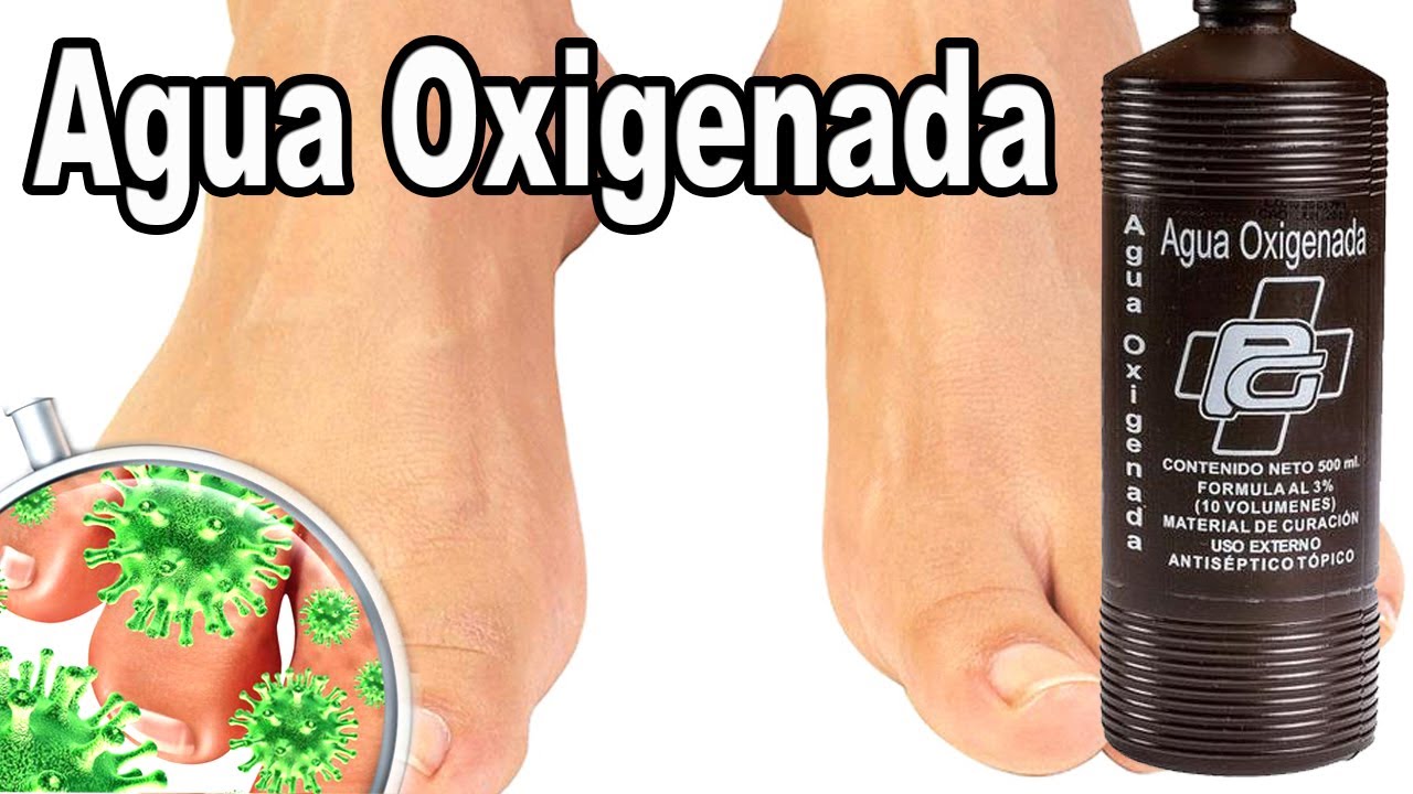 Agua Oxigenada para Hongos en las Uñas: Y sus 20 Beneficios