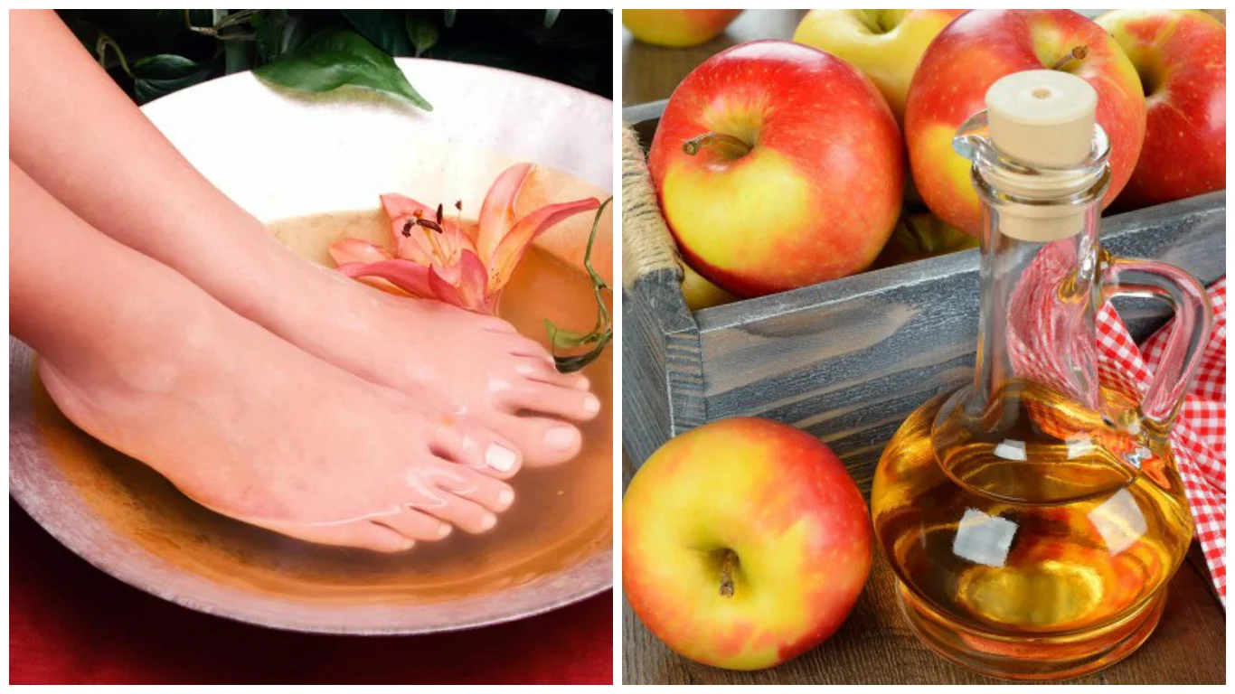Descubre 30 Beneficios de Mojar los Pies en Vinagre de Manzana: Una Terapia Natural