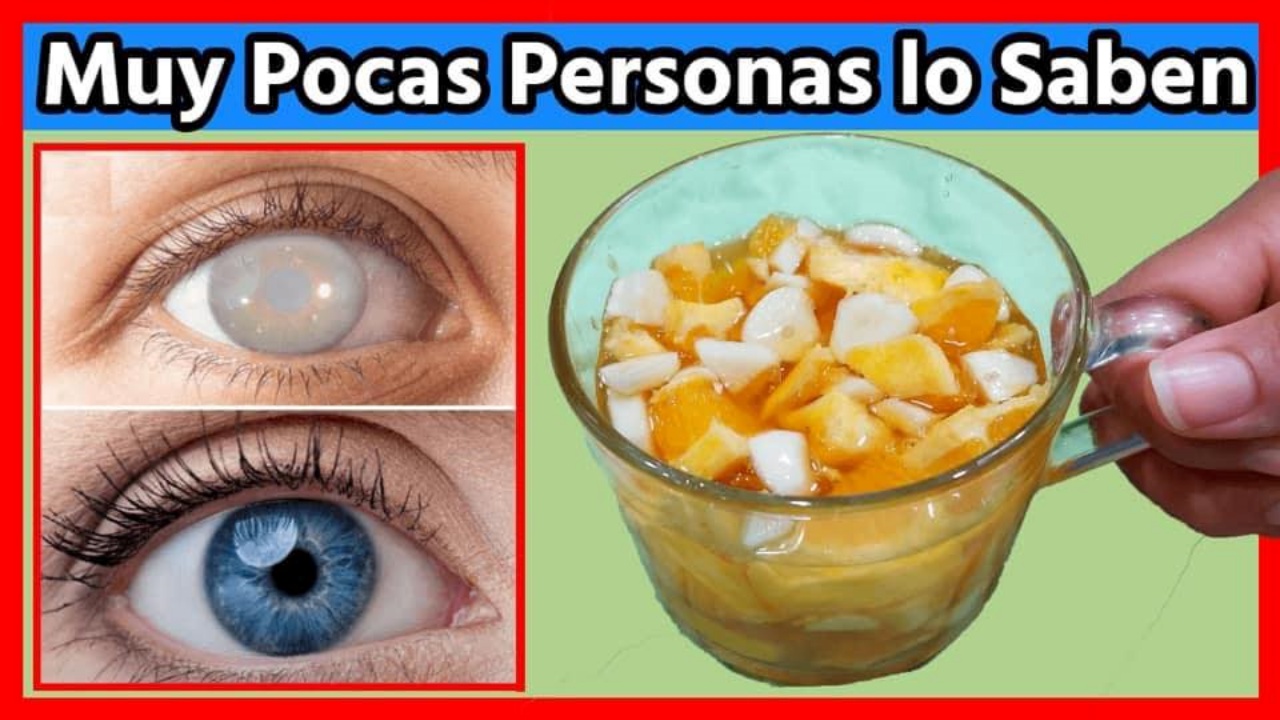 Remedio de Ajo, Naranja y Miel: Un Enfoque Natural para Mejorar la Visión
