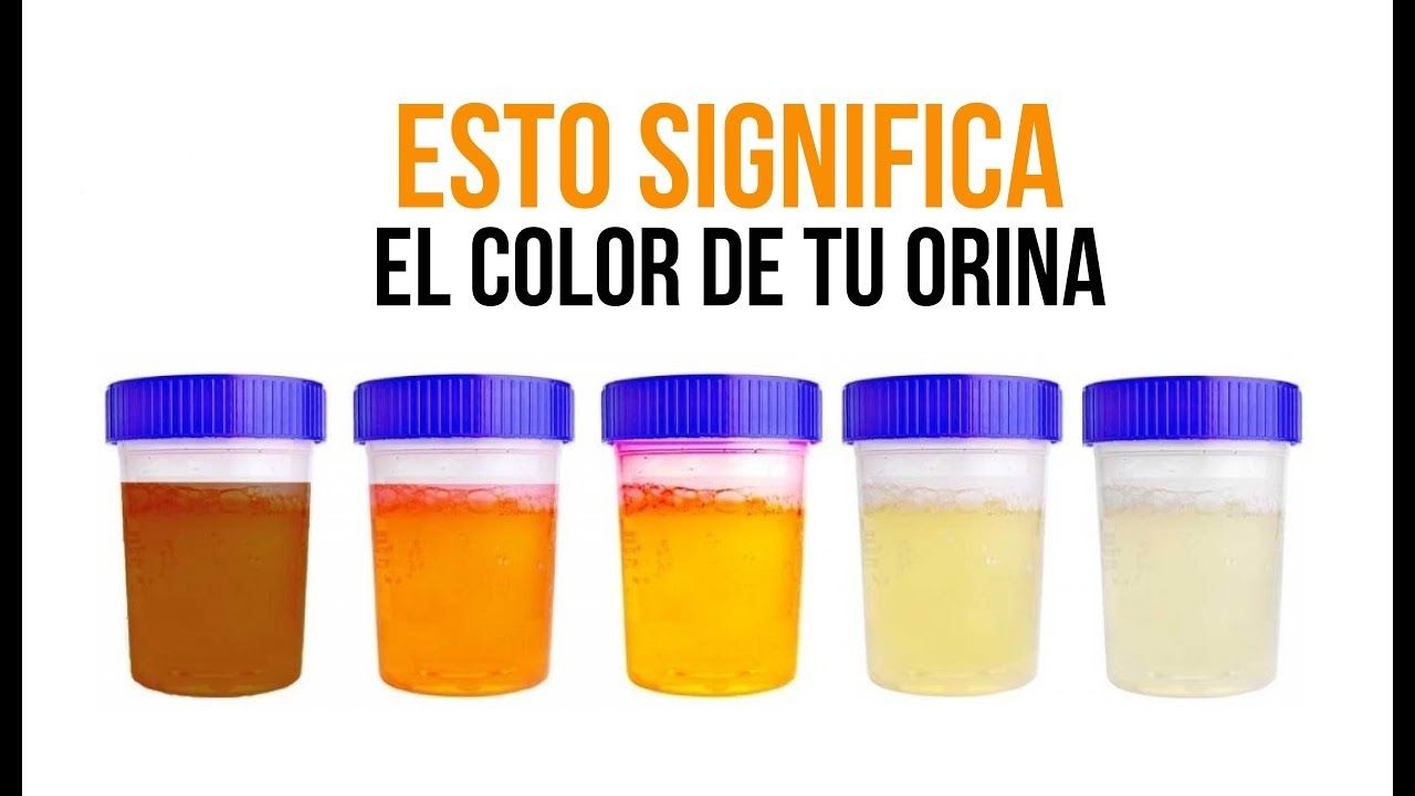 El Color de la Orina y su Significado para la Salud