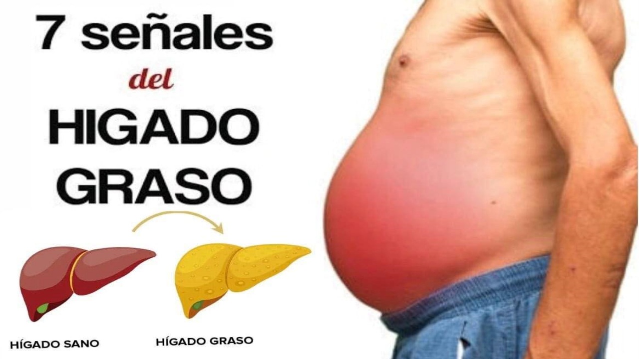 Hígado Graso: 7 Señales de Alerta y 5 Jugos para la Salud Hepática