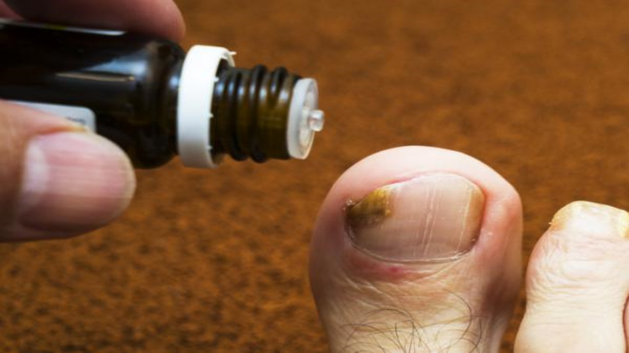 El Poder Curativo del Orégano: 4 Remedios para Eliminar Hongos en Uñas y Manos