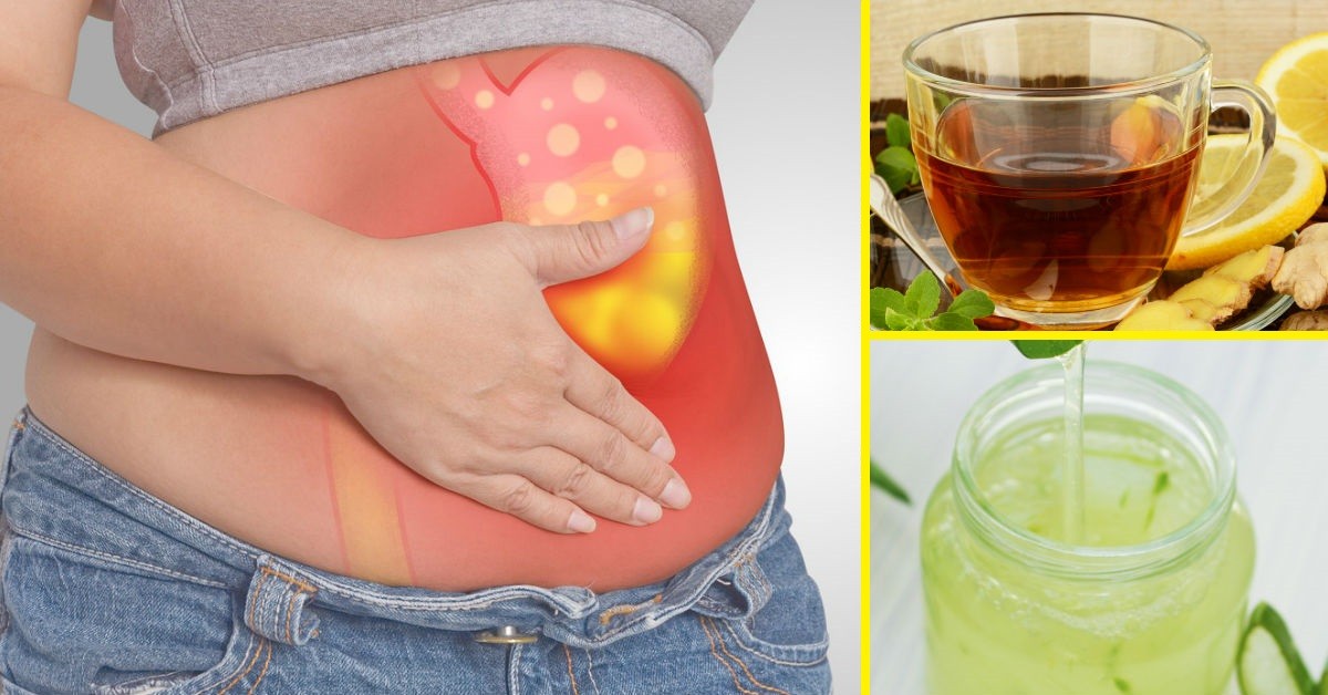 5 Bebidas Efectivas para Combatir la Acidez Estomacal