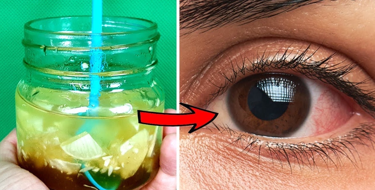 Botella casera para la visión: Limón, ajo, miel, jengibre, naranja y manzanilla