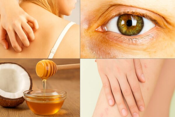 8 señales de que tu cuerpo está llorando por ayuda y cómo tratarlas con remedios naturales