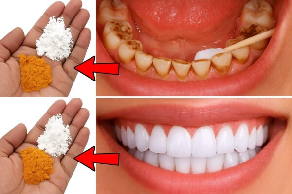 🌿 Cúrcuma y Bicarbonato: El Remedio Natural Que Limpia, Blanquea y Protege Tus Dientes